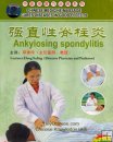 Ankylosing Spondylitis, Chinese Medicine Massage DVD Ankylosing Spondylitis, Chinese Medicine Massage DVD