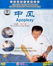 Apoplexy,Chinese Medicine Massage Cures Diseases in Good Effects Apoplexy,Chinese Medicine Massage Cures Diseases in Good Effects