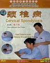Cervical Spondylosis, Chinese Medicine Massage Cures Diseases Cervical Spondylosis, Chinese Medicine Massage Cures Diseases