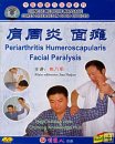 Periarthritis Humeroscapularis & Facial Paralysis, DVD Periarthritis Humeroscapularis & Facial Paralysis, DVD